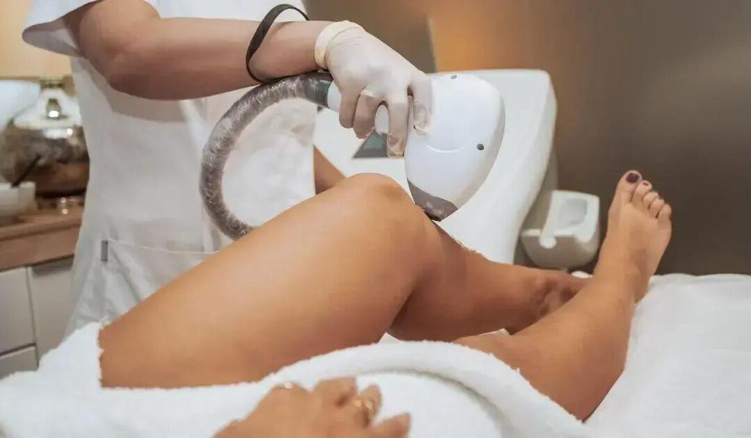 Clínica de estética com laser e bioestimulador em Campo Limpo Paulista
