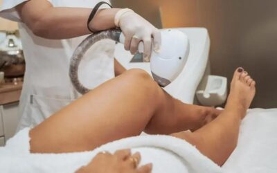 Clínica de estética com laser e bioestimulador em Campo Limpo Paulista