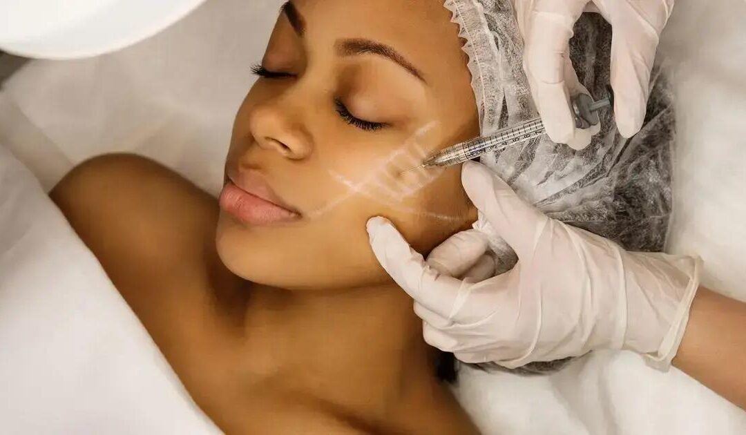 Bioestimulador facial com médica dermatologista jundiaí: realce sua beleza