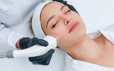 Bioestimulador facial com ácido polilático jundiaí: o que você precisa saber
